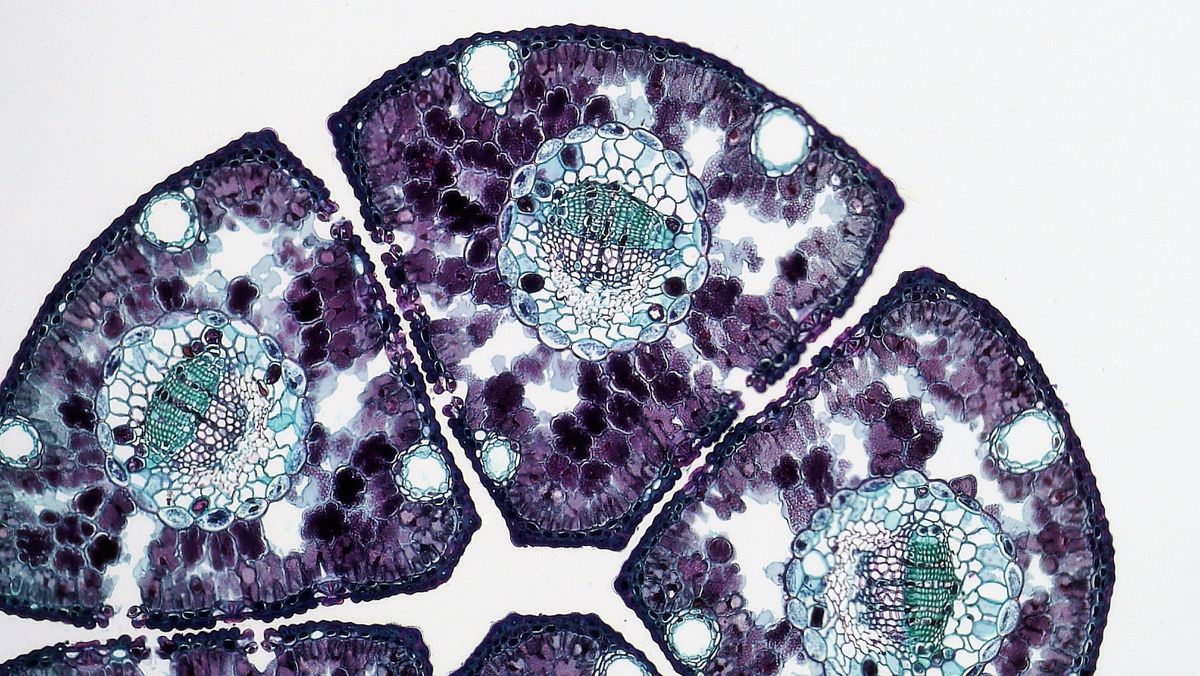 Microscopic view of plant tissue cross-section, illustrating the kind of cellular structure that controls how snake plant water-storage cells shrink during drought